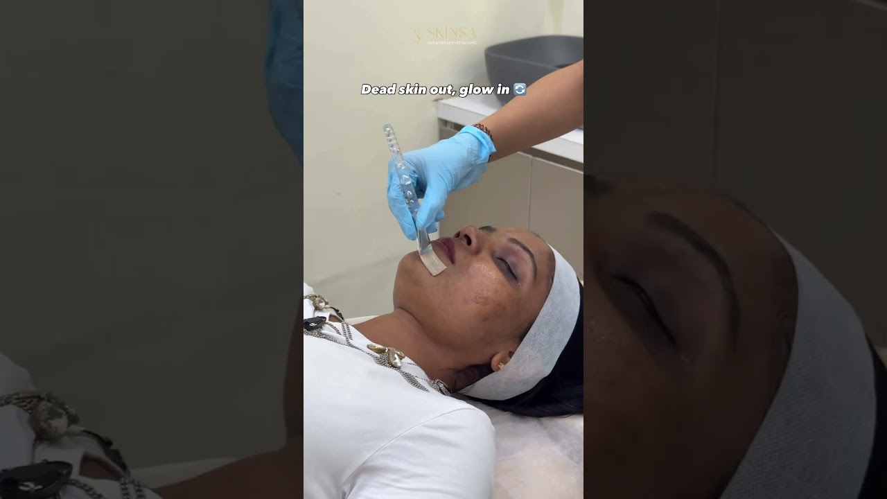 Tired of dull skin, acne marks & uneven tone? 