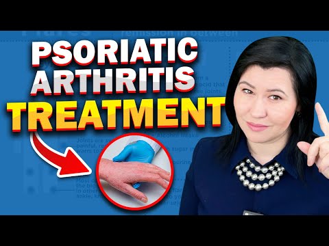Video: 4 způsoby léčby psoriatické artritidy a psoriázy