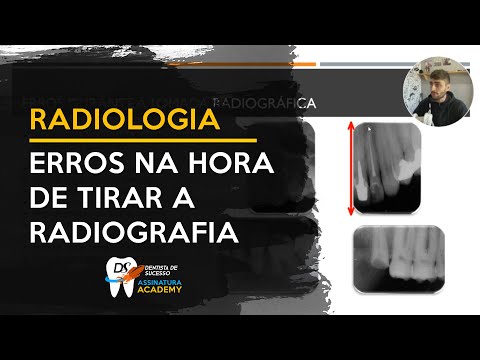 Vídeo: O que é alongamento em radiografia?
