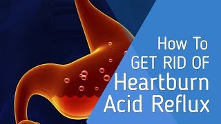 ✅ Does Alka Seltzer Help With Heartburn - Heartburn Remedy