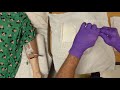 Central Line Cap Change - Sterile Techniques - Texas Children's Hospital©