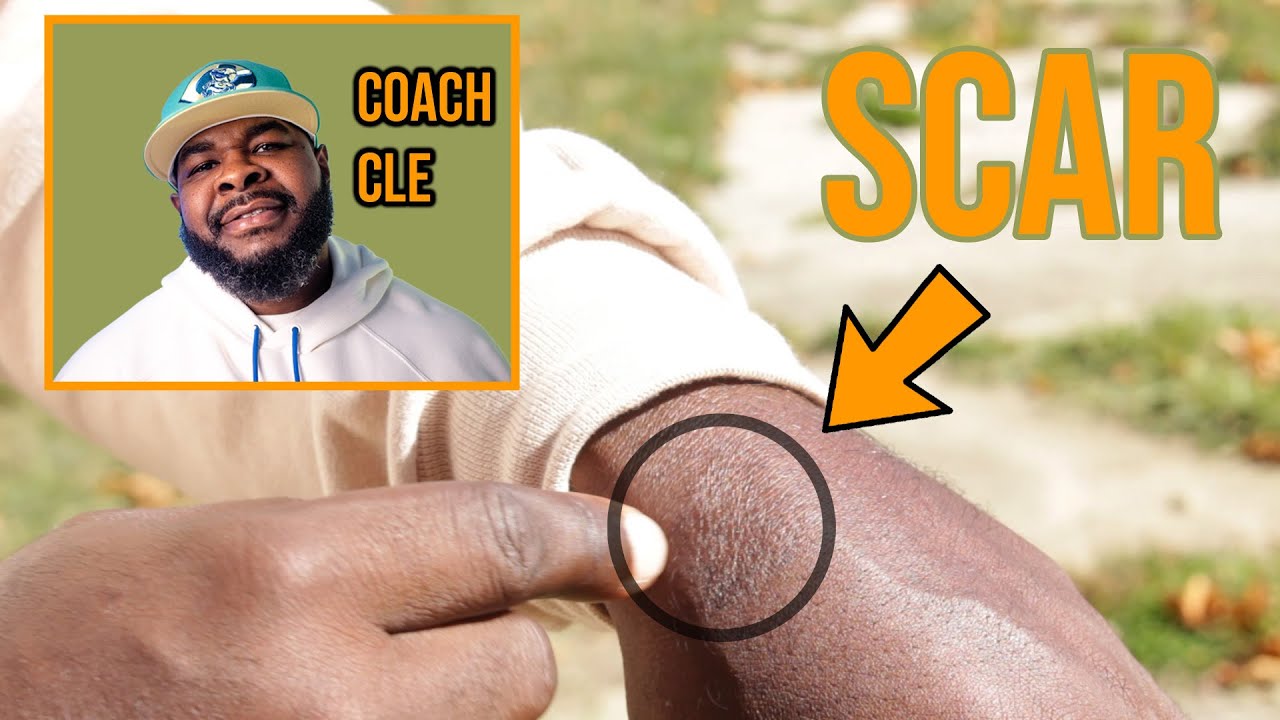Scratches, Scabs, & Scars