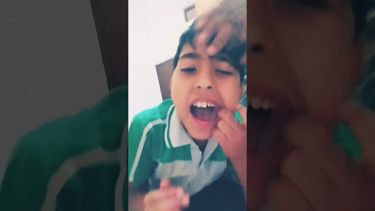 teeth चैकअप #funny #fun #jokes #duet #acting #comedy #shivanshpokhriyal20 #trending #reels #songs