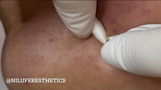 Satisfying Extractions 