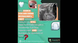 Do you Need a Ceph if you have Invisalign's CBCT Feature?