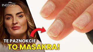 Te PAZNOKCIE to MASAKRA - naprawa zerwanego paznokcia krok po kroku | Indigo Nails