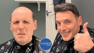 Before & After | Hair System | Non-Surgical Hair Replacement System Men/Women | UK/USA/International
