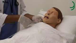 Ng Tube Insertion