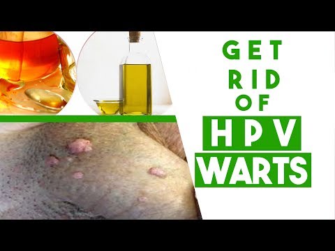 How to Get Rid of HPV Genital Warts at Home Fast - 3 Tips You MUST Know