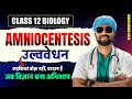 Amniocentesis (उल्ववेधन) | Class 12 Biology Bihar Board 2026 | Reproductive Health 