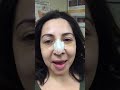 Rhinoplasty/Septoplasty/Chin implant 5 days ago