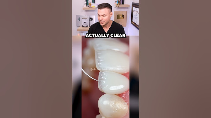 How to Get Veneers That DON’T Ruin Your Real Teeth!