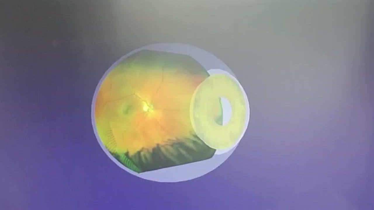 How Does the Optomap Work? | Eyecare Specialties in Missouri