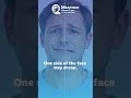 Bell’s Palsy Explained | Sudden Facial Drooping & Facial Nerve Weakness | Dr Bhumir Chauhan