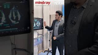 Mindray TEX 20 Product Introduction Amharic