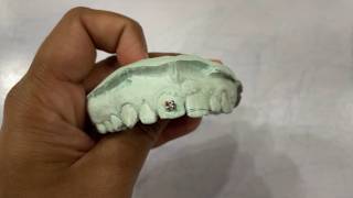 Step by Step Orthodontic Bonding of Brackets, Etching to Curing | Orthodontics Clinical Guide
