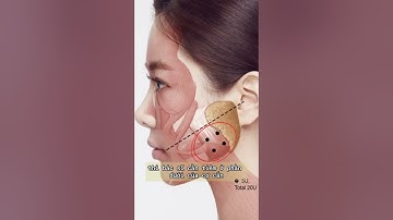 Biến chứng tiêm botox thon gọn hàm mà bạn nên biết l