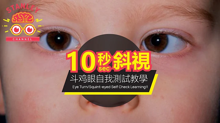 只需十秒！斜視/鬥雞眼自我在家測試教學|毋須專業儀器 ｜斜視測試｜鬥雞眼測試｜ - 天天要聞