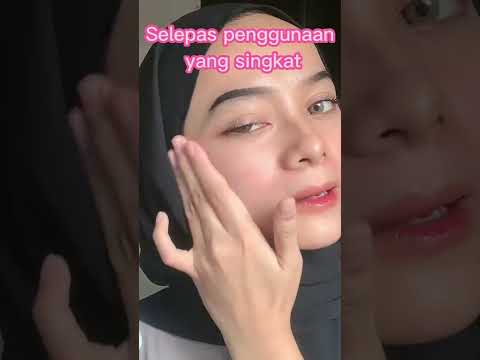 Video: Adakah jeragat dianggap melasma?