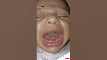 شكل اللسان المربوط Tong Tigh 2022 