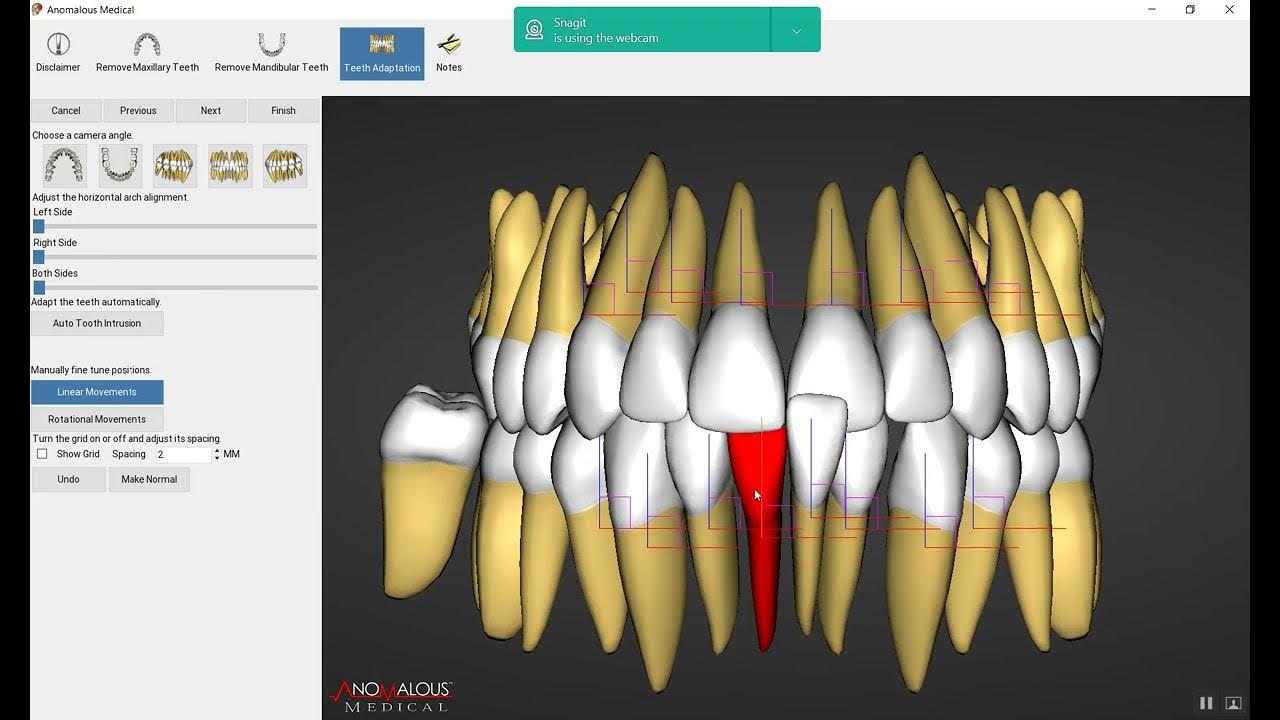 Orthodontic Terminology Part 2 YouTube