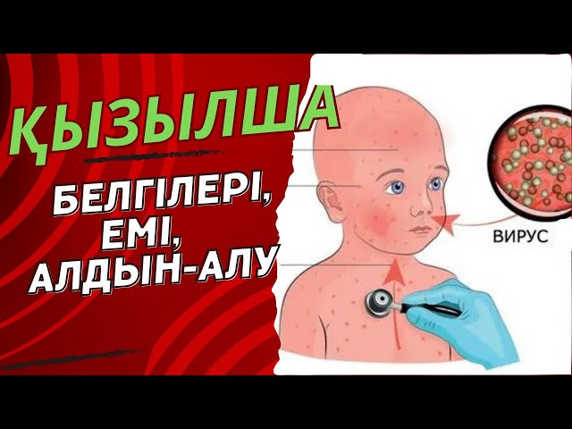 Менің әйелім шұңқыр.