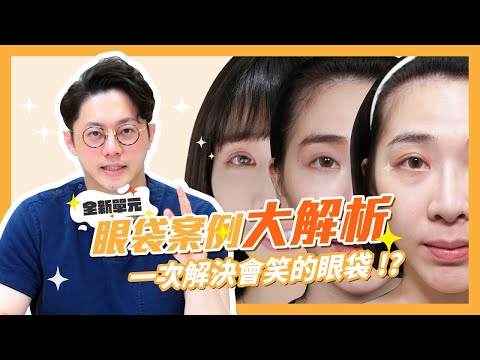 【醫美指南宮】眼袋案例大解析！一次解決會笑的眼袋｜周杰醫師