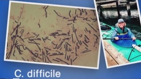 Non-Aggressive Strain of Bacteria Helps Reduce Recurrent C. difficile Infection