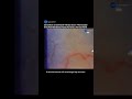 Scientists Created an AI Eye Scan That Could Replace Blood Tests Forever #eyes #science #medical