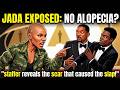 Jada Pinkett Smith's Alopecia Is A LIE? Will's Staffer Exposes the SCAR That Started the Oscar Slap!