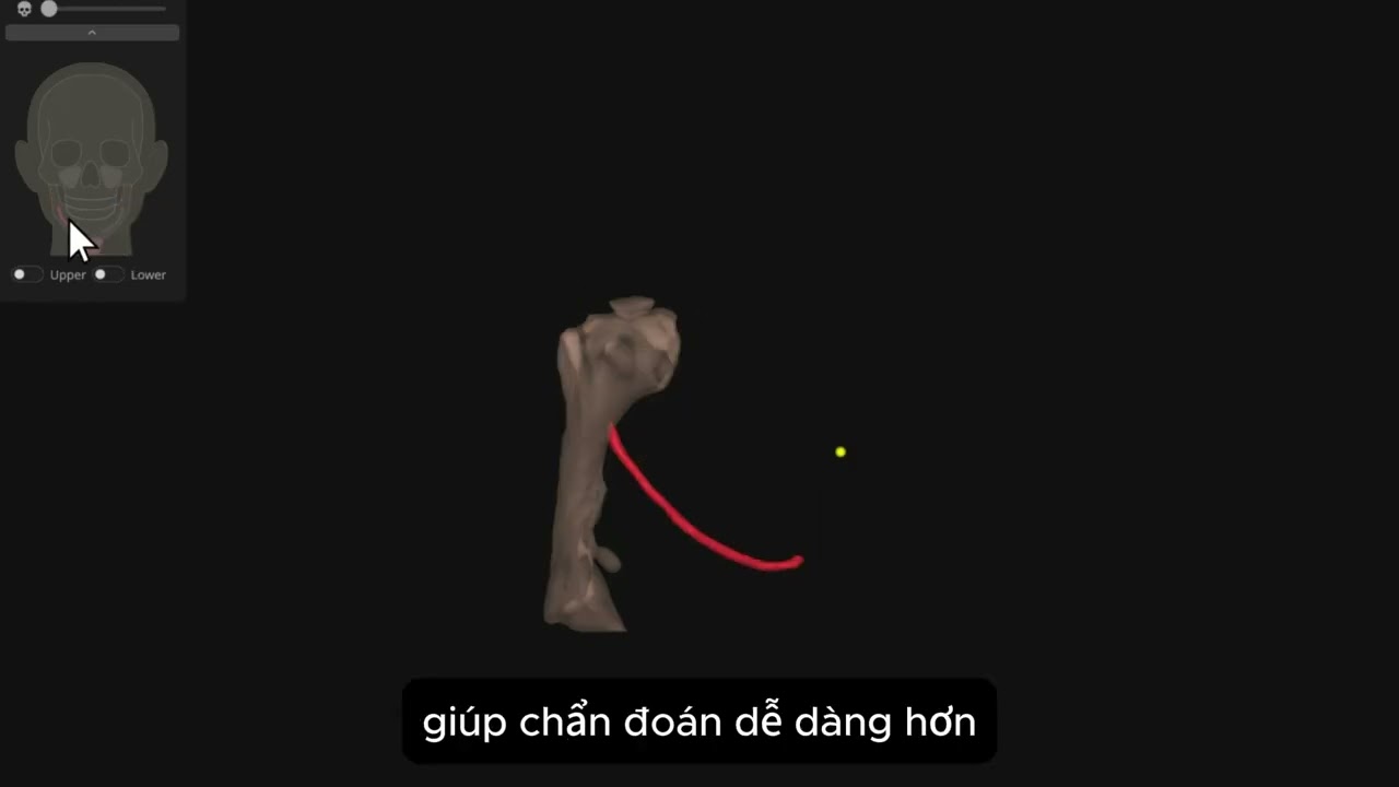 CTCB + Rayface Ray 5D