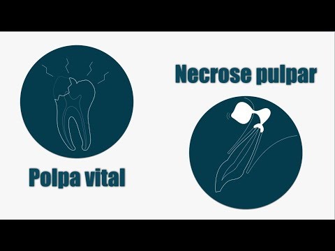 Vídeo: Observando Em Tempo Real A Evolução Da Resistência à Artemisinina Em Plasmodium Falciparum