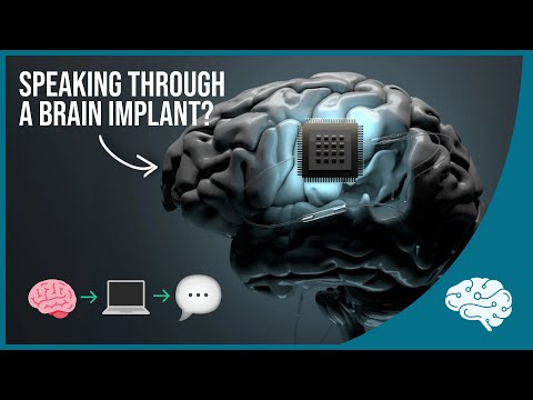 Brain Implant Restores Speech to Paralyzed Man
