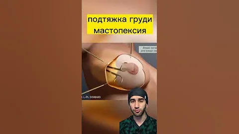 грудь опустилась что делать?