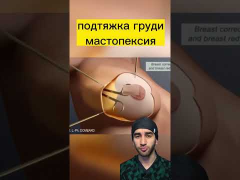 грудь опустилась что делать?
