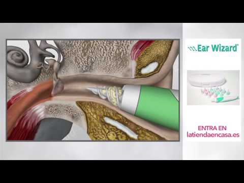 Vídeo: Taps D’orella De Silicona: Com Utilitzar Taps D’orella De Silicona Anatòmics I De Plàstic? Quin és Millor? Com Retallar Per Adaptar-se?