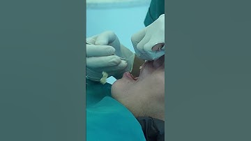 Quy Trình Lắp Răng Sứ Cercon: Từ Tư Vấn Đến Nụ Cười Hoàn Hảo | Dr Cường Official