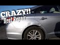 Hyundai Sonata | Extreme Auto Dent Repair | PDR | Dentless Touch | Paintless dent repair