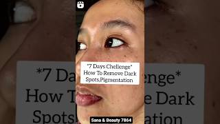 Homemade pack remove dark spots, pigmentation vairalvideo youtubeshorts vairalshort shortvideo