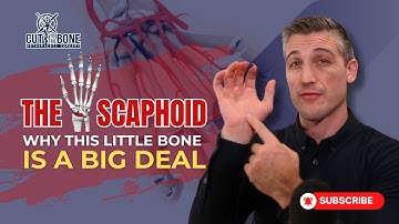 Uitleg over scaphoidfracturen: waarom dit kleine polsbotje belangrijk is!