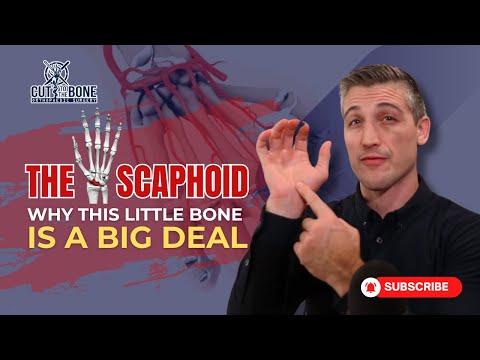 Scaphoid Fractures Explained: