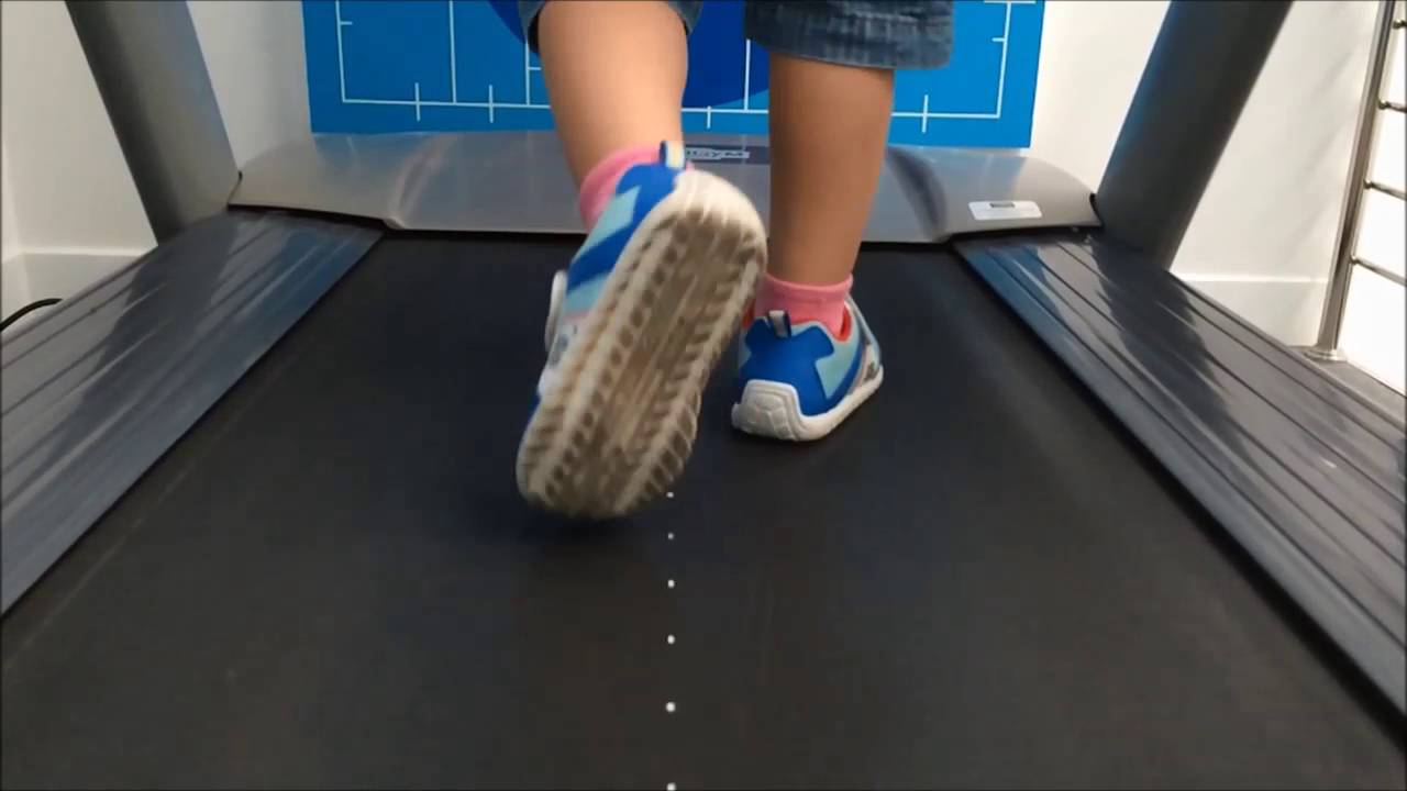 CHILDREN GAIT ANALYSIS AFTER WEARING ORTHOTICS