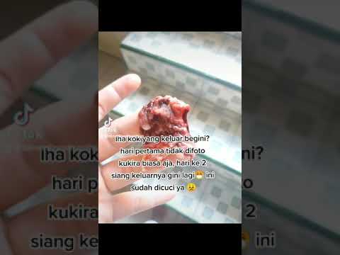 Video: Cara Mencegah Bercak pada Kontrol Kelahiran (dengan Gambar)