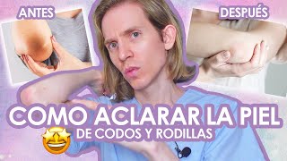 COMO ACLARAR CODOS Y RODILLAS - Recomendaciones de un Dermatólogo - Simon Scarano