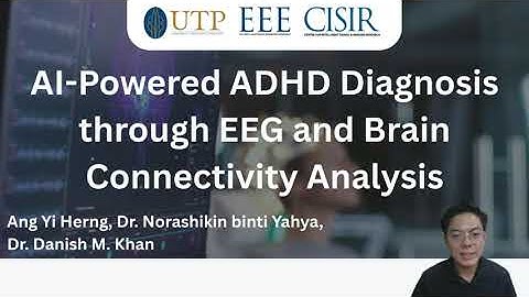 AI-Powered ADHD Diagnosis through EEG and Brain Connectivity Analysis