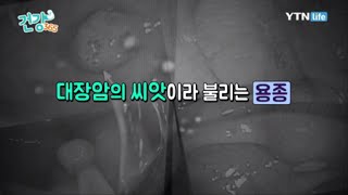 대장암 검진 방법 / YTN 라이프