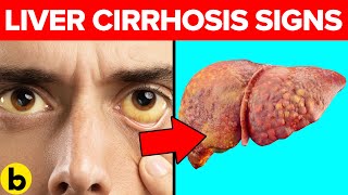 Warning Signs, Symptoms & Causes Of Cirrhosis Of The Liver