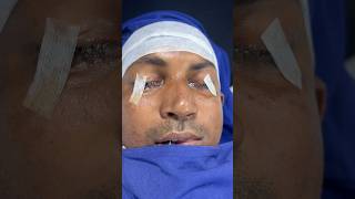 Best Broken post accident Redo Nosejob by expert Dr Richardson