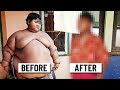 World's Fattest Boy now looks like THIS!