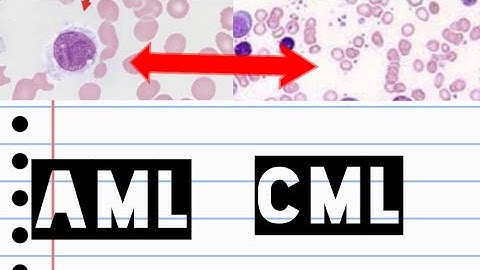 AML & CML | Acute myeloid leukemia | Chronic myeloid leukemia | pathology slide identification |
